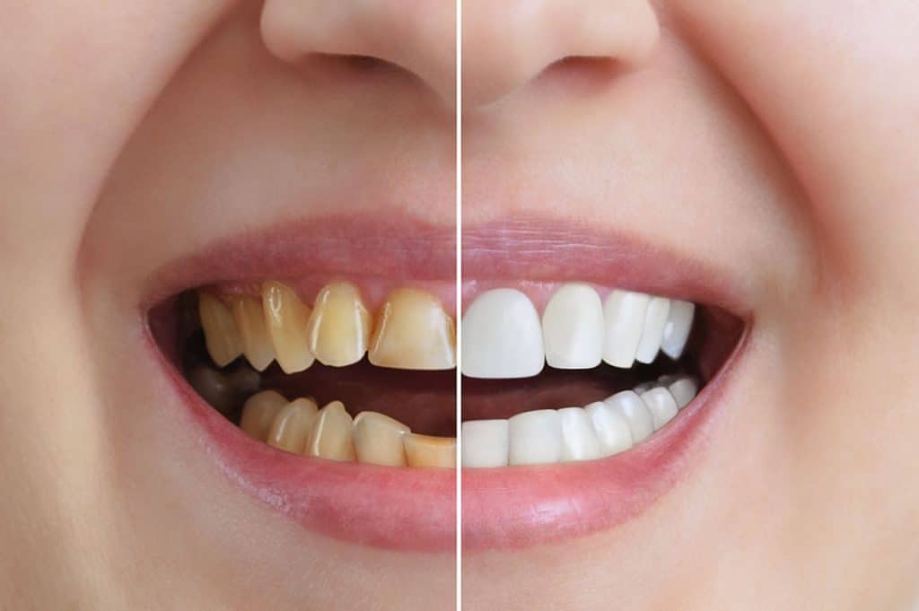 Estética dental